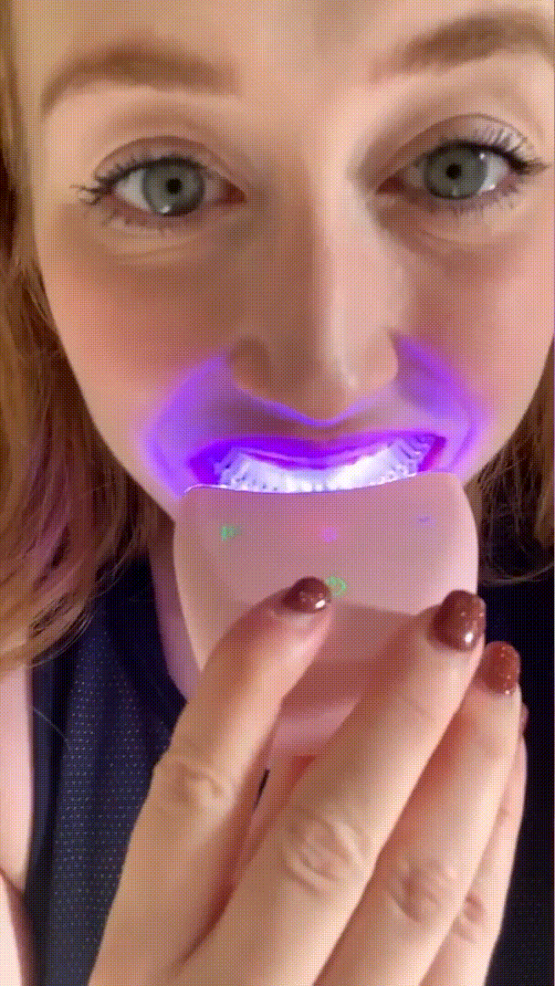 Kit Blanqueador con Luz LED